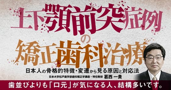 上下顎前突症例の矯正歯科治療