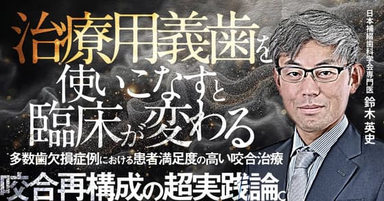 治療用義歯を使いこなすと臨床が変わる