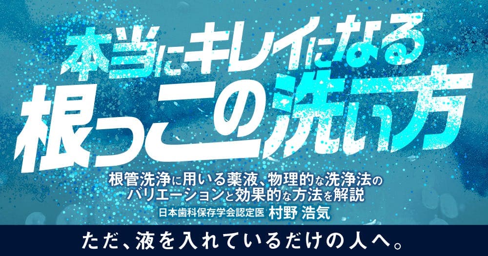 本当にキレイになる根っこの洗い方 - 根管洗浄に用いる薬液、物理的な洗浄法のバリエーションと効果的な方法を解説