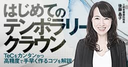 はじめての「テンポラリークラウン」