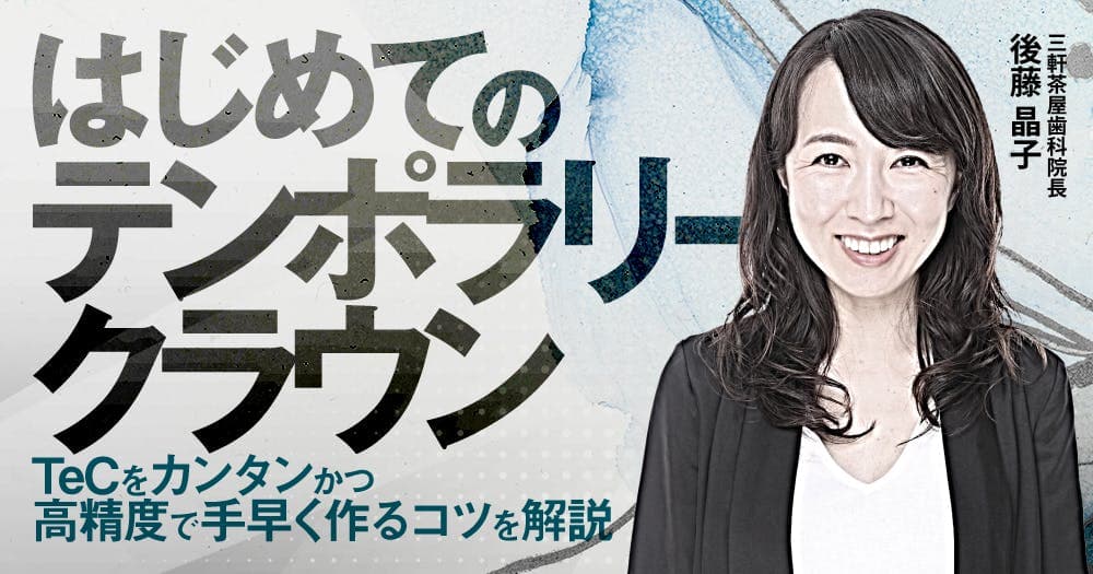 はじめての「テンポラリークラウン」