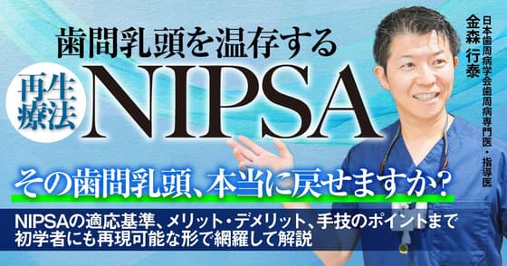 歯間乳頭を温存する再生療法「NIPSA」のテクニック