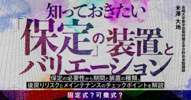 知っておきたい「保定」の装置とバリエーション