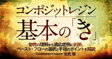 コンポジットレジン基本の『き』