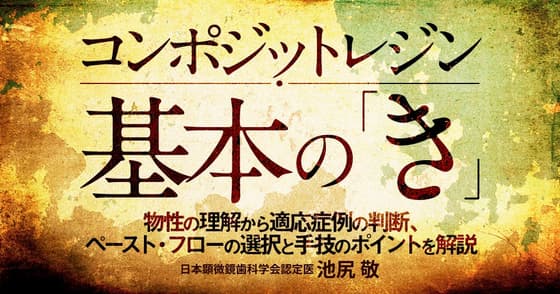 コンポジットレジン基本の『き』