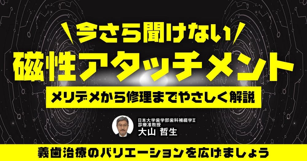 今さら聞けない「磁性アタッチメント」 - メリデメから修理までやさしく解説