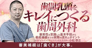 歯間乳頭をキレイにつくる歯周外科