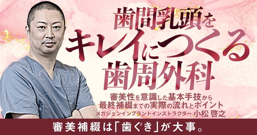 歯間乳頭をキレイにつくる歯周外科