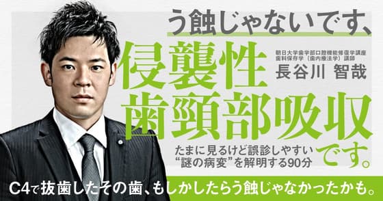 う蝕じゃないです、「侵襲性歯頸部吸収」です。