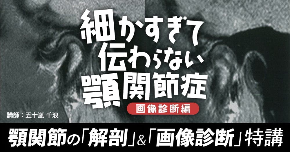 細かすぎて伝わらない顎関節症＜診断編＞ - 顎関節の解剖と画像診断