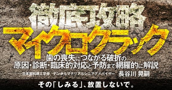 徹底攻略マイクロクラック