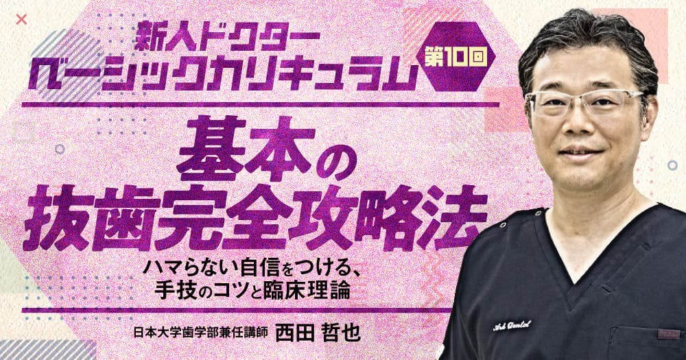 基本の抜歯完全攻略法