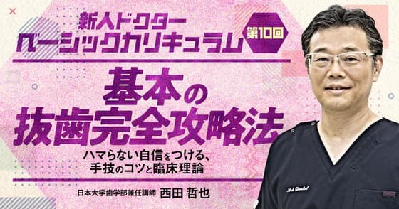 基本の抜歯完全攻略法