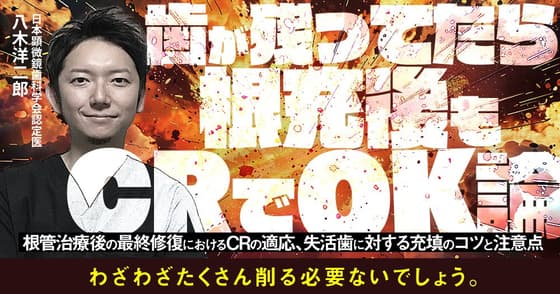 歯が残ってたら根充後もCRでOK論
