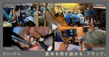 【治療見学】フラップオペ（上顎両側中切歯・側切歯）