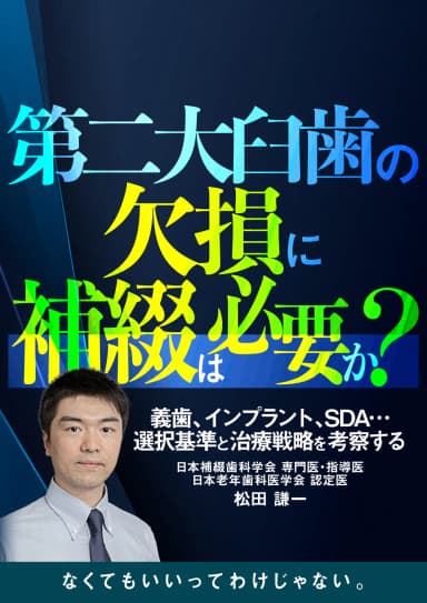 ランキング8位の第二大臼歯の欠損に補綴は必要か？