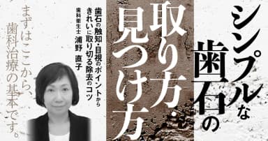 シンプルな歯石の取り方・見つけ方