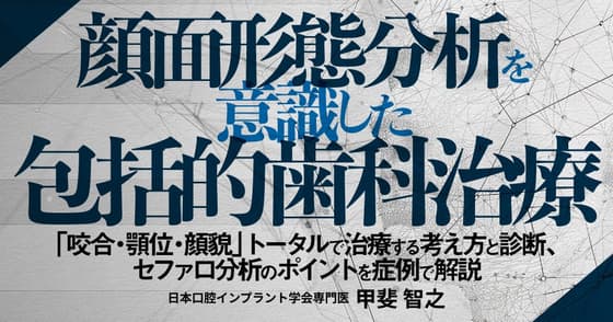 顔面形態分析を意識した包括的歯科治療