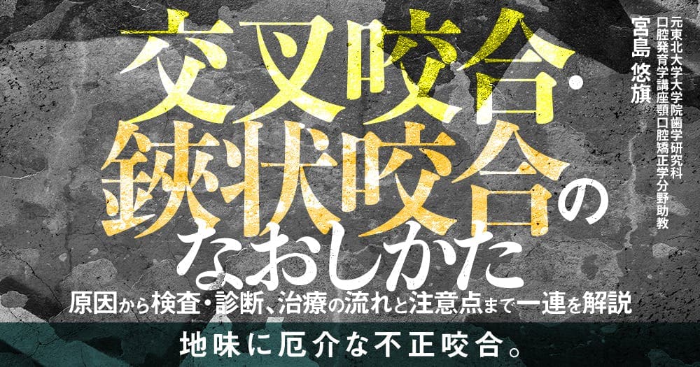 交叉咬合・鋏状咬合のなおしかた - 原因から検査・診断、治療の流れと注意点まで一連を解説