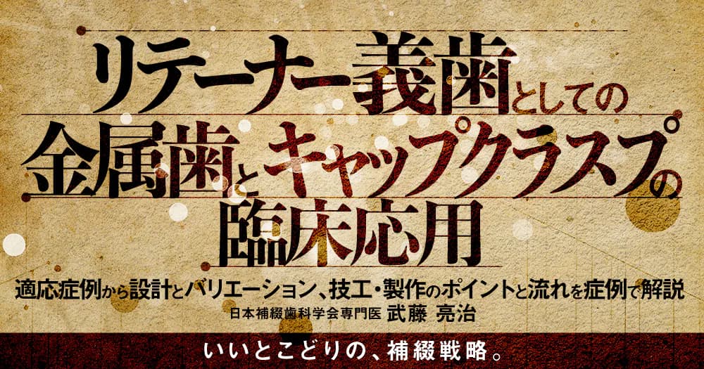 リテーナー義歯としての金属歯とキャップクラスプの臨床応用