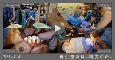 【治療見学】歯周組織再生療法（上顎両側中切歯・側切歯）