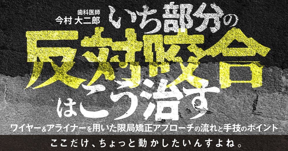 いち部分の反対咬合はこう治す