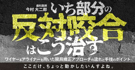 いち部分の反対咬合はこう治す