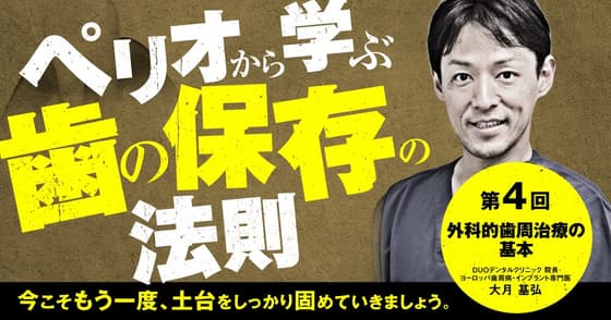 ペリオから学ぶ歯の保存の法則【第四回】