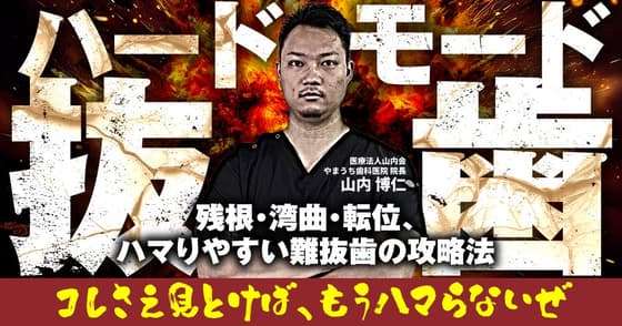 ハードモード抜歯。歯根分割するタイミングや抜歯できない場合はどうする？