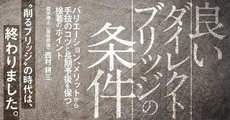 良いダイレクトブリッジの条件