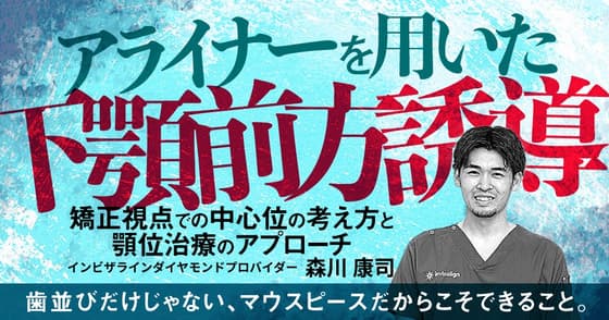 アライナーを用いた下顎前方誘導