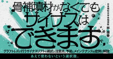 骨補填材がなくてもサイナスはできます