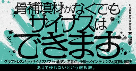 骨補填材がなくてもサイナスはできます