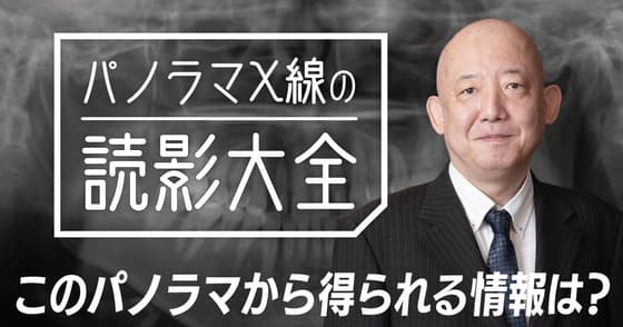 パノラマX線「読影」大全。X線診断について解説