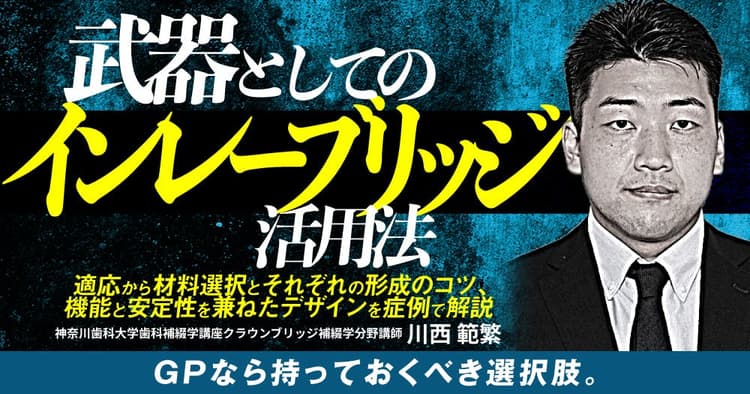 武器としての「インレーブリッジ」活用法