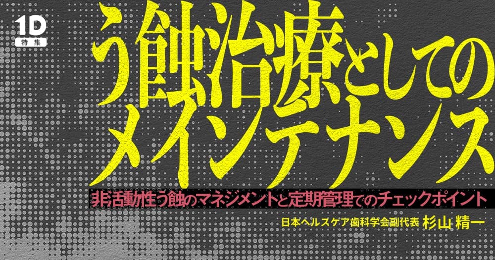 う蝕治療としてのメインテナンス - 非活動性う蝕のマネジメントと定期管理でのチェックポイント