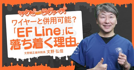 ワイヤーと併用可能？「EF Line」に落ち着く理由。
