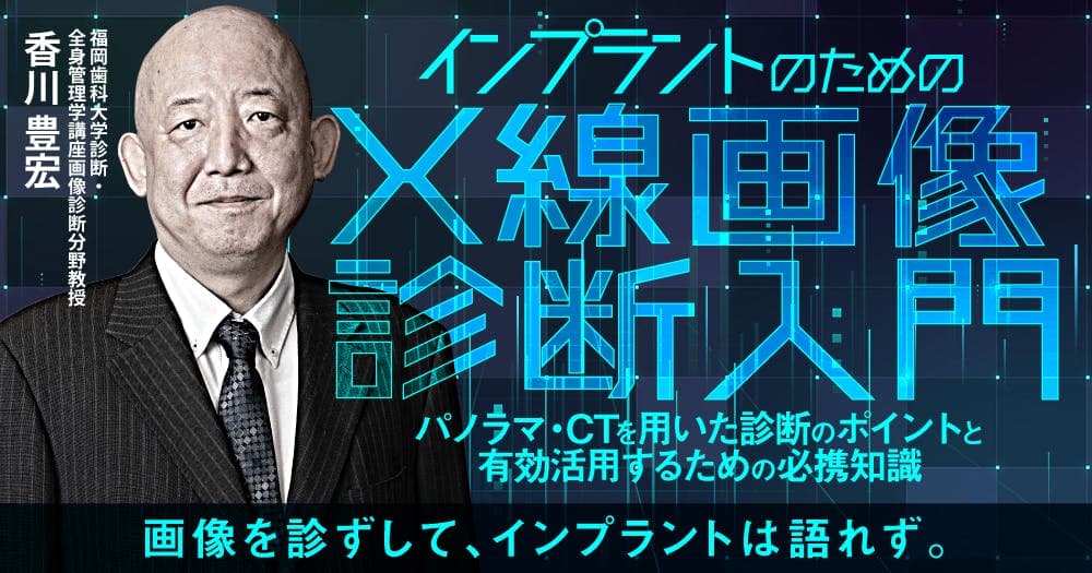 インプラントのためのX線画像診断入門 - パノラマ・CTを用いた診断のポイントと有効活用するための必携知識
