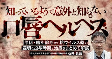 知っているようで意外と知らない「口唇ヘルペス」