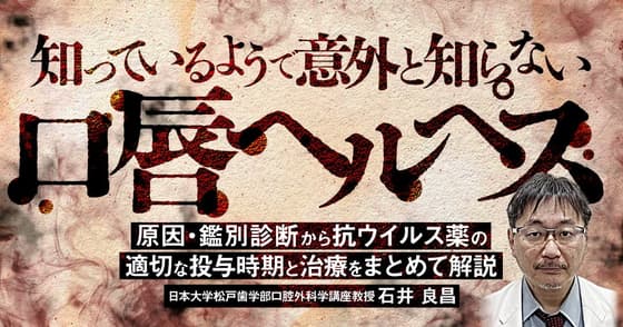 知っているようで意外と知らない「口唇ヘルペス」