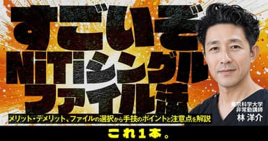 すごいぞNiTiシングルファイル法