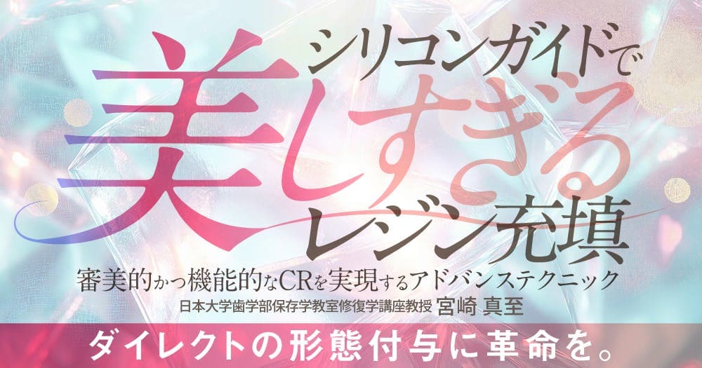 シリコンガイドで美しすぎるレジン充填