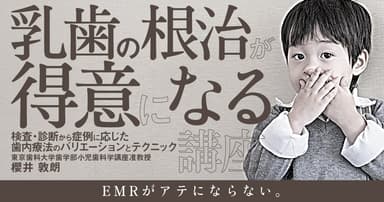 乳歯の根治が得意になる講座