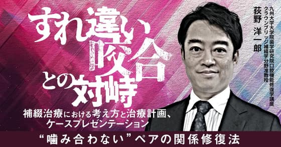 すれ違い咬合との対峙