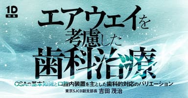 エアウェイを考慮した歯科治療