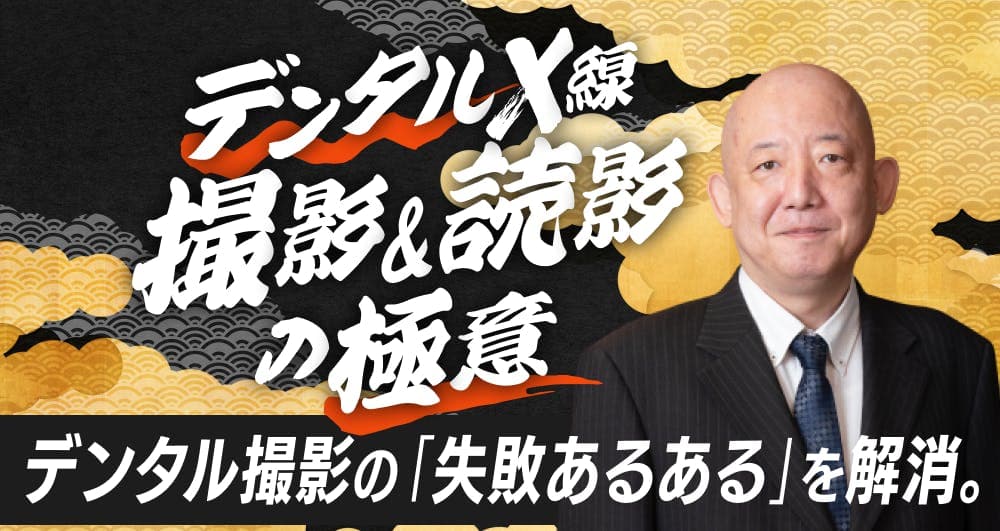 デンタルX線「撮影&読影」の極意。X線診断を解説。