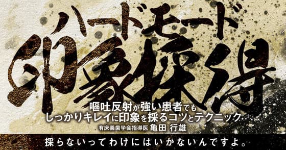 ハードモード印象採得