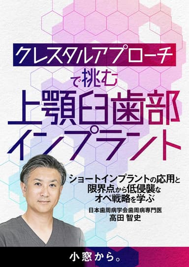 ランキング6位の「クレスタルアプローチ」で挑む上顎臼歯部インプラント