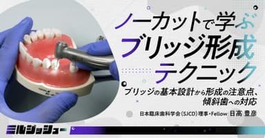 ノーカットで学ぶ「ブリッジ形成」テクニック