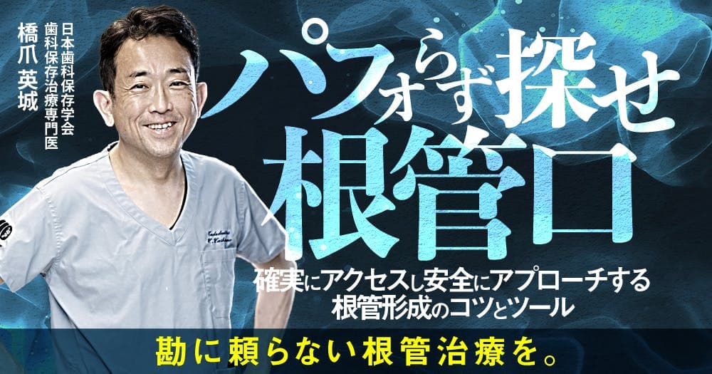 パフォらず探せ根管口 - 確実にアクセスし安全にアプローチする根管形成のコツとツール